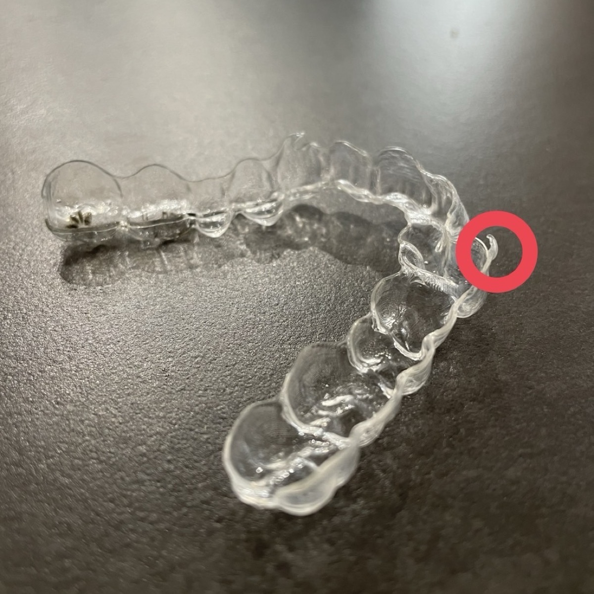 マウスピースの端が歪んでトゲのようになっている状態