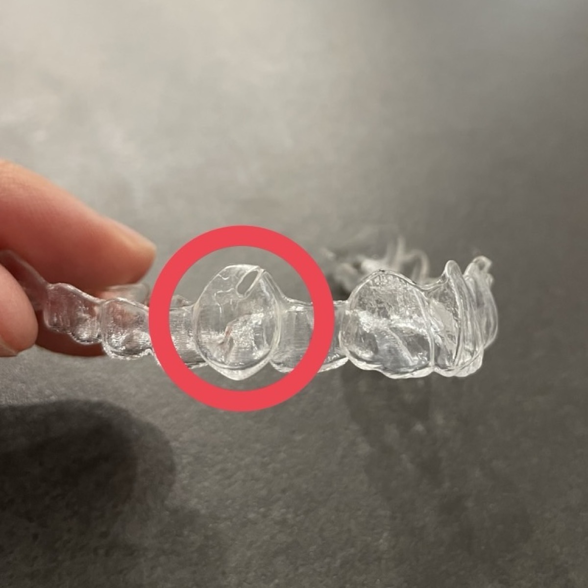 マウスピースを横から見たフック（切り込み）部分